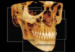 Skull for imaging