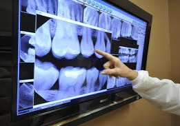 Dentist reviewing digital xray