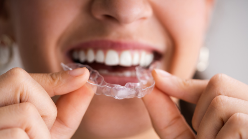 Woman wearing clear aligners