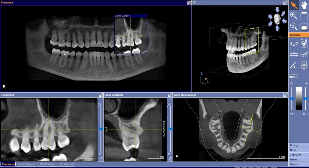 A CBCT scan