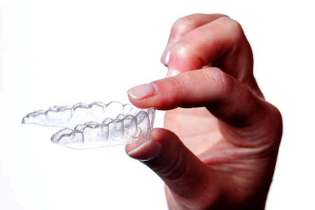 aligners